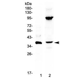 Western blot testing of 1) mouse NIH3T3 and 2) human A549 cell lysate with IL12 p40 antibody at 0.5u
