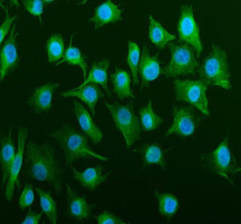 Immunofluorescent staining of Tubulin Alpha using anti-Alpha Tubulin antibody (green). Tubulin Alpha
