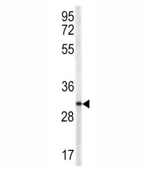 Western blot analysis of TRAP antibody and NCI-H460 lysate. Expected molecular weight: 29-39 kDa (de