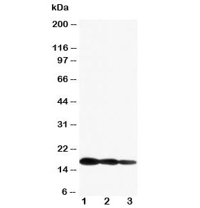 Western blot testing of IL1 beta antibody and Lane 1: Recombinant mouse IL1b partial protein 10ng; 2