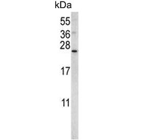 Western blot testing of mouse NIH 3T3 cell lysate with Sorting nexin-24 antibody. Predicted molecula