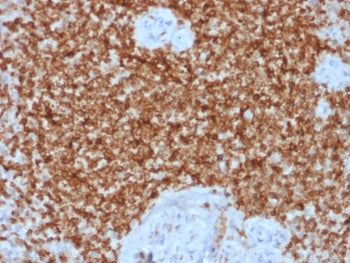 IHC testing of FFPE human spleen tissue with recombinant Bcl2 antibody (clone BCL2/1878R). HIER: boi