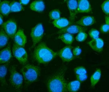 Immunofluorescent staining of FFPE human Caco-2 cells with cGAS antibody (green) and DAPI nuclear st