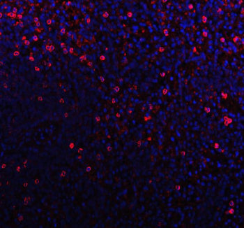 Immunofluorescent staining of FFPE human tonsil tissue with CD79b antibody (red) and DAPI nuclear st