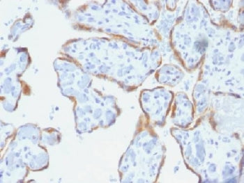 TIMP2 Antibody