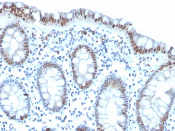 Histone H3 Antibody (pSer10)