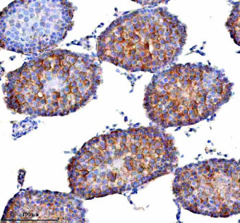 Immunohistochemical staining of STAMBP using anti-STAMBP antibody. STAMBP was detected in a paraffin