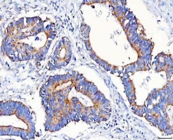 METAP1D Antibody / Methionine aminopeptidase 1D / MAP1D