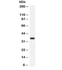Arginase 1 Antibody