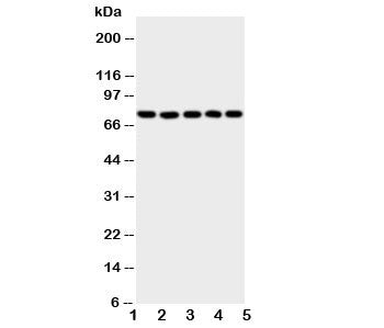 Western blot testing of 5-Lipoxygenase antibody and Lane 1: SW620; 2: Jurkat; 3: COLO320; 4: A549; 5