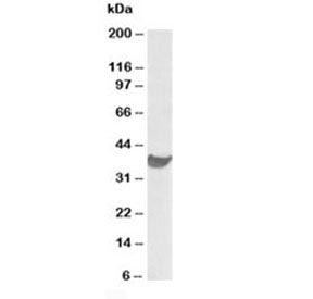 PD-L1 Antibody