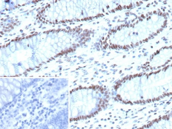 IHC staining of FFPE human colon tissue with ARID1A antibody (clone ARID1A/7736). Inset: PBS used in