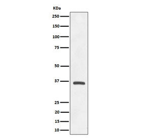Western blot testing of human A549 cell lysate with OXGR1 antibody. Predicted molecular weight ~38 k