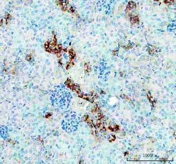 IHC staining of FFPE rat testis tissue with TIM-1 antibody. HIER: steam section in pH6 citrate buffe