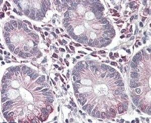 IHC testing of FFPE human small intestine with SLC10A2 antibody at 4ug/ml. HIER: steamed with pH6 ci