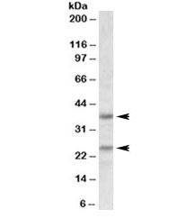Western blot testing of human cerebellum lysate with Podoplanin antibody at 1ug/ml. Predicted molecu