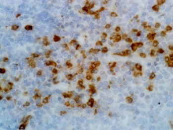 IHC testing of FFPE human tonsil tissue with recombinant Human Kappa Light Chain antibody. A pH6 Cit