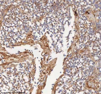 IHC staining of FFPE human tonsil tissue with MIPEP antibody. HIER: boil tissue sections in pH8 EDTA