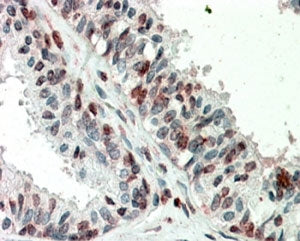 IHC testing of FFPE human prostate with ZIC3 antibody at 5ug/ml. HIER: steamed with pH6 citrate buff