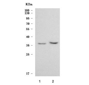 SGTB Antibody / SGT2