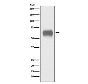 Western blot testing of human plasma lysate with CD5 antibody. Observed molecular weight: 55~67 kDa 