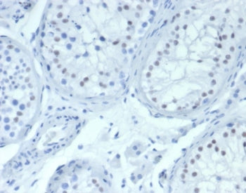 IHC staining of FFPE human testis tissue with Wilm's Tumor antibody (clone WT1/7452). HIER: boil tis