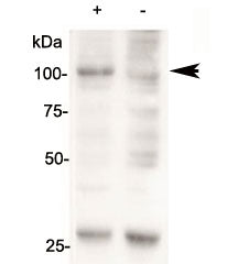 AARS2 Antibody