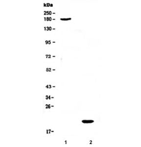Western blot testing of 1) human COLO320 and 2) human placenta lysate with COL18A1 antibody at 0.5ug