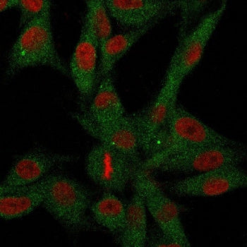 Immunofluorescence staining of human U-87 MG cells with CD73 antibody (green, clone NT5E/2646) and R