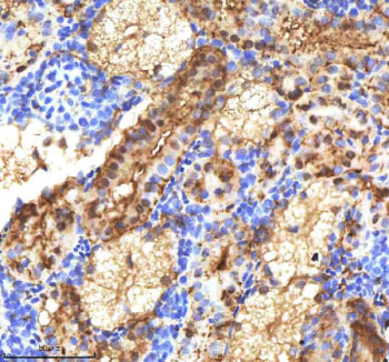 IHC staining of FFPE zebrafish kidney tissue with Etv2 antibody, HRP-labeled secondary and DAB subst
