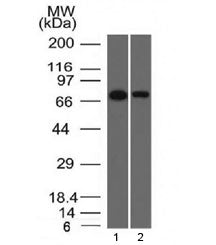 Western blot testing of human 1) HeLa and 2) A431 cell lysate with Endoglin antibody (clone ENG/1327