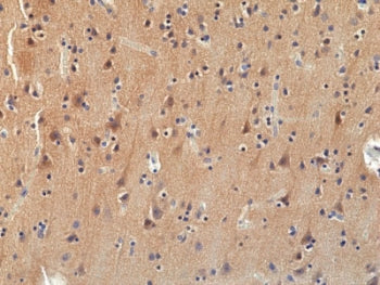 Pan TRK Antibody / TrkA/B/C