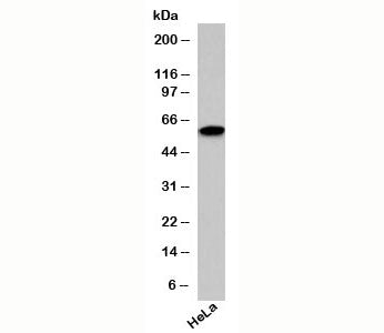 Western blot testing of human samples with SIN1 antibody at 1ug/ml.