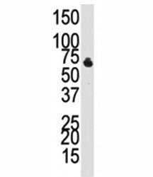 Western blot analysis of BMPR1B antibody and NCI-H460 cell lysate. Predicted molecular weight 55-60 