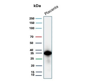 Western blot testing of human placental tissue lysate with EBI3 antibody (clone EBI3/8903). Predicte