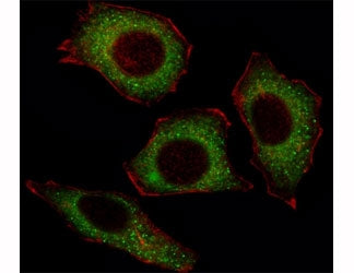 Fluorescent image of U251 cell stained with p65 antibody at 1:25. Immunoreactivity is localized to t