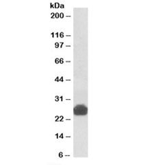 Western blot testing of rat liver lysate with Gsta5 antibody at 0.3ug/ml. Predicted molecular weight