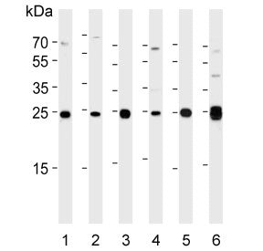 Western blot testing of human 1) A431, 2) HeLa, 3) HepG2, 4) MCF7, 5) Raji and 6) mouse kidney lysat