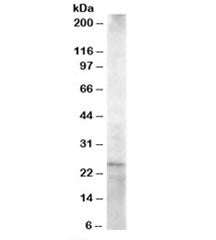 Western blot testing of Jurkat lysate with HIP2 antibody at 1.5ug/ml. Predicted molecular weight: ~2