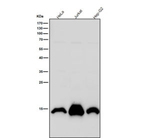 Western blot testing of human samples using the Histone H2A (mono methyl K118) antibody at 1:5000 di