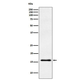 Western blot testing of human fetal brain lysate with Gamma Synuclein antibody. Expected molecular w