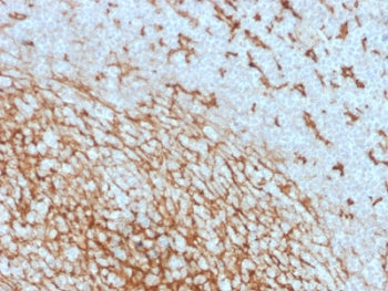 IHC testing of FFPE human tonsil with CD14 antibody (clone LPSR/2408). HIER: boil tissue sections in