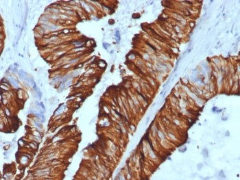 Cytokeratin 20 Antibody