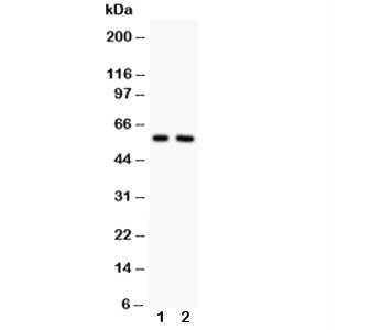 Western blot testing of Alkaline Phosphatase antibody and Lane 1: rat heart; 2: rat brain. Predicted