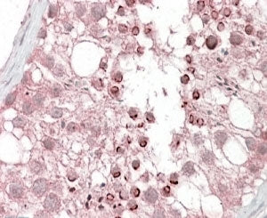 USP28 Antibody