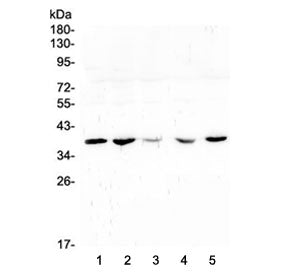 Western blot testing of human 1) placenta, 2) U-2 OS, 3) A431, 4) HeLa and 5) A549 lysate with uPAR 