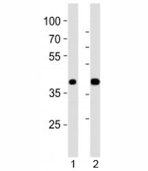 PDX1 Antibody