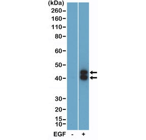 Western blot testing of lysate from human A431 cells, non-treated (-) or treated (+) with EGF, using