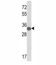 His Tag Antibody
