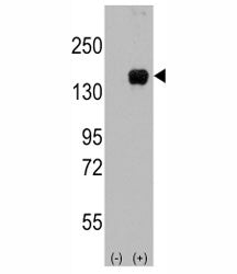 ASK1 Antibody
